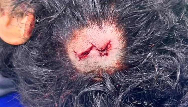 عاجل: إحصائية أولية صادمة لضحايا إطلاق الرصـ.ـاص العشوائي في المكلا