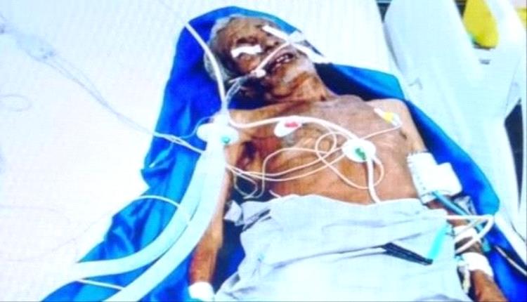 الاعتداء على رجل مسن في الحديدة اليمنية