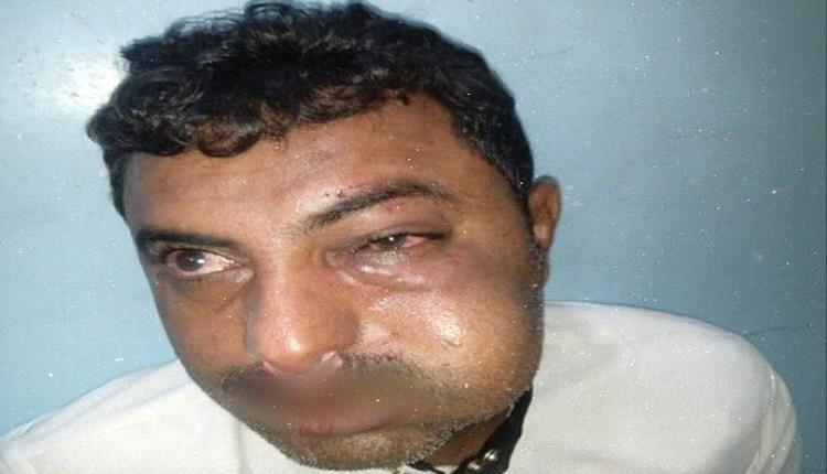 اعتداء حو.ثي على محامٍ في الحديدة يثير موجة استنكار واسعة

