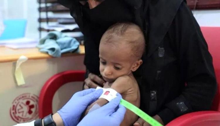 بسبب حـ,ـرب الحـ.ـوثي.. «التقزم» يحاصر أطفال اليمن