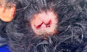 عاجل: إحصائية أولية صادمة لضحايا إطلاق الرصـ.ـاص العشوائي في المكلا