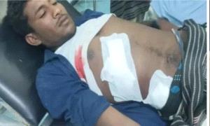 إصابة نازح بقـ.ـصف حو.ثي طال مخيم الحيمة جنوبي الحديدة