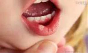 أمراض الفم في الطفولة قد ترتبط بحالة صحية قاتلة في البلوغ