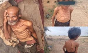 الجوع يحصد أرواح نازحين في عبس 