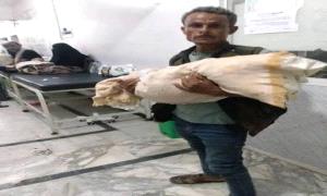 وفاة طفلة أمام مستشفى بتعز تثير غضبًا واسعًا وتحقيقات عاجلة لكشف الملابسات