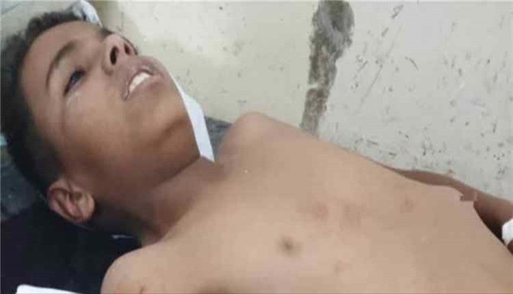 ضحايا جدد للألغـ,ـام الحـ,ـوثية.. إصابة شقيقين بانفجـ,ـار عـ,ـبوة ناسـ,ـفة بريف تعز