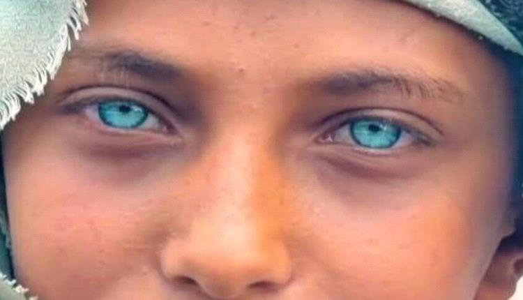 "رسام" اليمني يخطف أضواء الحرب بعينيه ويتحول لظاهرة على السوشيال ميديا